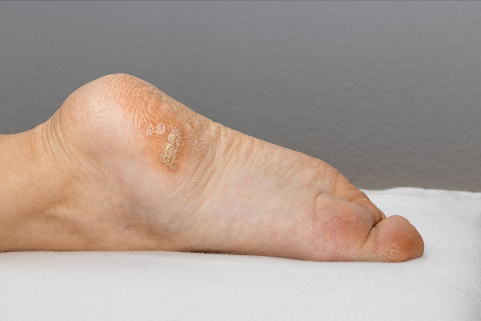 Foot skin examination by a podiatrist